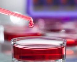 cell culture
